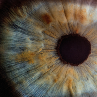 Iridology